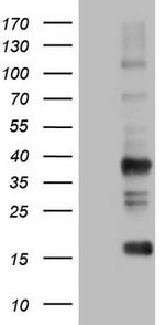 TACC2 Antibody in Western Blot (WB)