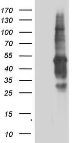 TACC2 Antibody in Western Blot (WB)