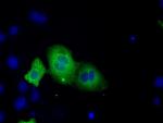 TACC3 Antibody in Immunocytochemistry (ICC/IF)