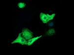 TACC3 Antibody in Immunocytochemistry (ICC/IF)