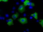 TACC3 Antibody in Immunocytochemistry (ICC/IF)