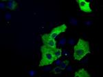 TACC3 Antibody in Immunocytochemistry (ICC/IF)