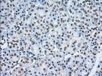 TACC3 Antibody in Immunohistochemistry (Paraffin) (IHC (P))