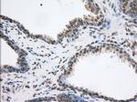 TACC3 Antibody in Immunohistochemistry (Paraffin) (IHC (P))