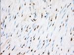 TACC3 Antibody in Immunohistochemistry (Paraffin) (IHC (P))