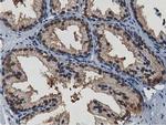 TACC3 Antibody in Immunohistochemistry (Paraffin) (IHC (P))