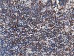 TACC3 Antibody in Immunohistochemistry (Paraffin) (IHC (P))