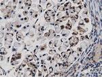 TACC3 Antibody in Immunohistochemistry (Paraffin) (IHC (P))