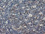 TACC3 Antibody in Immunohistochemistry (Paraffin) (IHC (P))