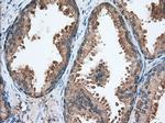 TACC3 Antibody in Immunohistochemistry (Paraffin) (IHC (P))