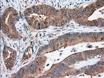 TACC3 Antibody in Immunohistochemistry (Paraffin) (IHC (P))