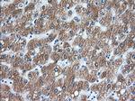 TACC3 Antibody in Immunohistochemistry (Paraffin) (IHC (P))