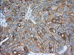 TACC3 Antibody in Immunohistochemistry (Paraffin) (IHC (P))