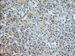 TACC3 Antibody in Immunohistochemistry (Paraffin) (IHC (P))