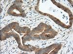 TACC3 Antibody in Immunohistochemistry (Paraffin) (IHC (P))