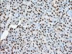 TACC3 Antibody in Immunohistochemistry (Paraffin) (IHC (P))