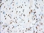 TACC3 Antibody in Immunohistochemistry (Paraffin) (IHC (P))