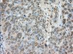 TACC3 Antibody in Immunohistochemistry (Paraffin) (IHC (P))