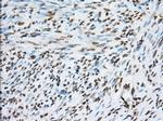 TACC3 Antibody in Immunohistochemistry (Paraffin) (IHC (P))