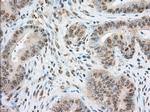 TACC3 Antibody in Immunohistochemistry (Paraffin) (IHC (P))