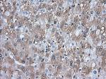 TACC3 Antibody in Immunohistochemistry (Paraffin) (IHC (P))