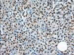 TACC3 Antibody in Immunohistochemistry (Paraffin) (IHC (P))