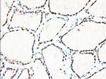 TACC3 Antibody in Immunohistochemistry (Paraffin) (IHC (P))