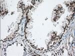 TACC3 Antibody in Immunohistochemistry (Paraffin) (IHC (P))