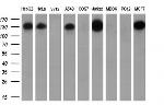 TACC3 Antibody in Western Blot (WB)