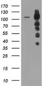 TACC3 Antibody in Western Blot (WB)