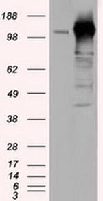 TACC3 Antibody in Western Blot (WB)