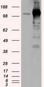 TACC3 Antibody in Western Blot (WB)