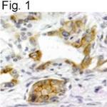 TACR1 Antibody in Immunohistochemistry (Paraffin) (IHC (P))