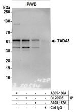 TADA3/TADA3L Antibody in Immunoprecipitation (IP)