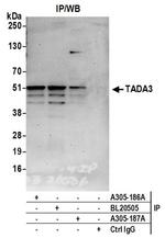 TADA3/TADA3L Antibody in Immunoprecipitation (IP)