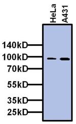 TAF5 Antibody in Western Blot (WB)