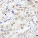 TAF6 Antibody in Immunohistochemistry (IHC)