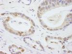 TAF6 Antibody in Immunohistochemistry (IHC)