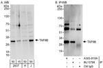 TAF9B Antibody in Western Blot (WB)