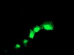 TAGLN Antibody in Immunocytochemistry (ICC/IF)