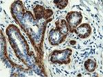 TAGLN Antibody in Immunohistochemistry (Paraffin) (IHC (P))