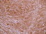 TAGLN Antibody in Immunohistochemistry (Paraffin) (IHC (P))