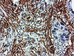 TAGLN Antibody in Immunohistochemistry (Paraffin) (IHC (P))