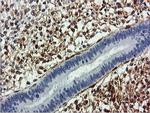 TAGLN Antibody in Immunohistochemistry (Paraffin) (IHC (P))