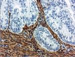 TAGLN Antibody in Immunohistochemistry (Paraffin) (IHC (P))