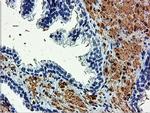 TAGLN Antibody in Immunohistochemistry (Paraffin) (IHC (P))