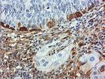 TAGLN Antibody in Immunohistochemistry (Paraffin) (IHC (P))