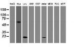 TAGLN Antibody in Western Blot (WB)