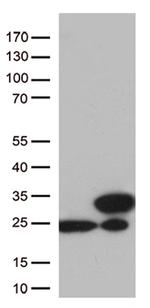TAGLN2 Antibody in Western Blot (WB)