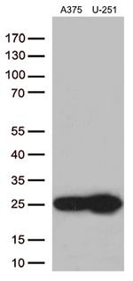 TAGLN2 Antibody in Western Blot (WB)